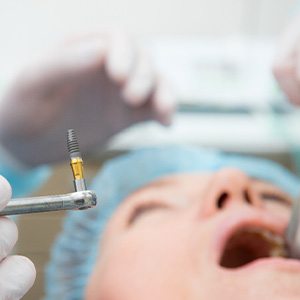 A person having dental implant surgery