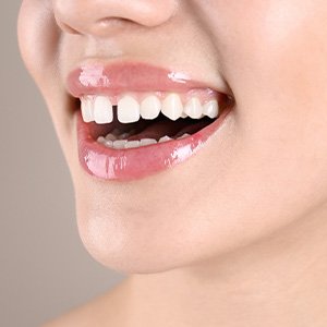 Nose-to-neck view of woman with diastema smiling