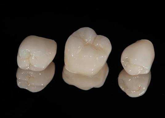 Dental crowns