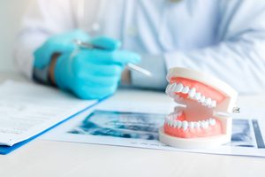 Hands of dentist at desk with treatment plan and fake teeth